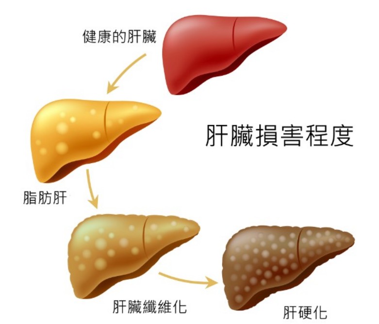 嚴重肝腎功能不全患者 嚴重肝腎功能不全患者