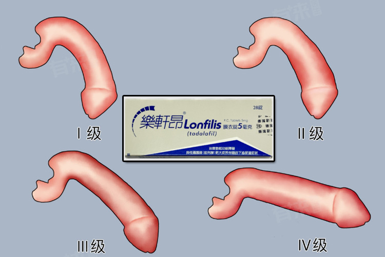 樂軒昂 5mg 什麼人最適合使用? 樂軒昂 5mg 什麼人最適合使用?